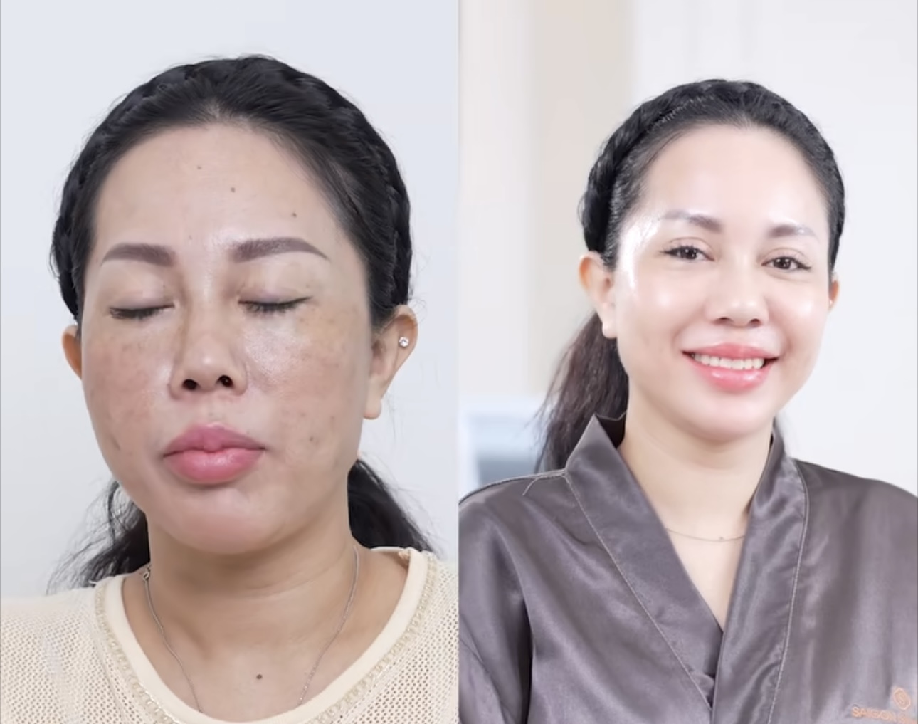 Kem đặc trị sắc tố Melanin WS (số 5) - Ảnh 2