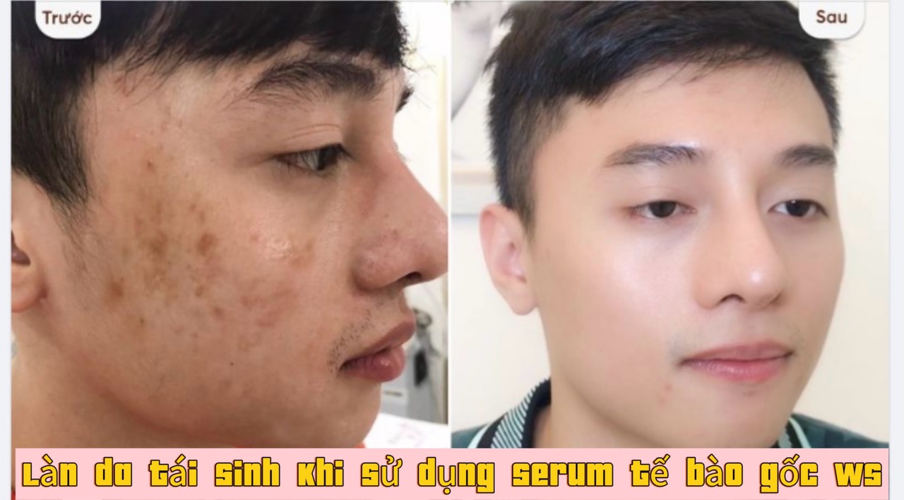 Serum tế bào gốc dưỡng da WS số 2 (dành cho nam) - Ảnh 3