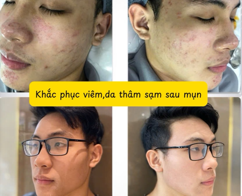 Kem dưỡng đêm WS số 4 (men) - Ảnh 3