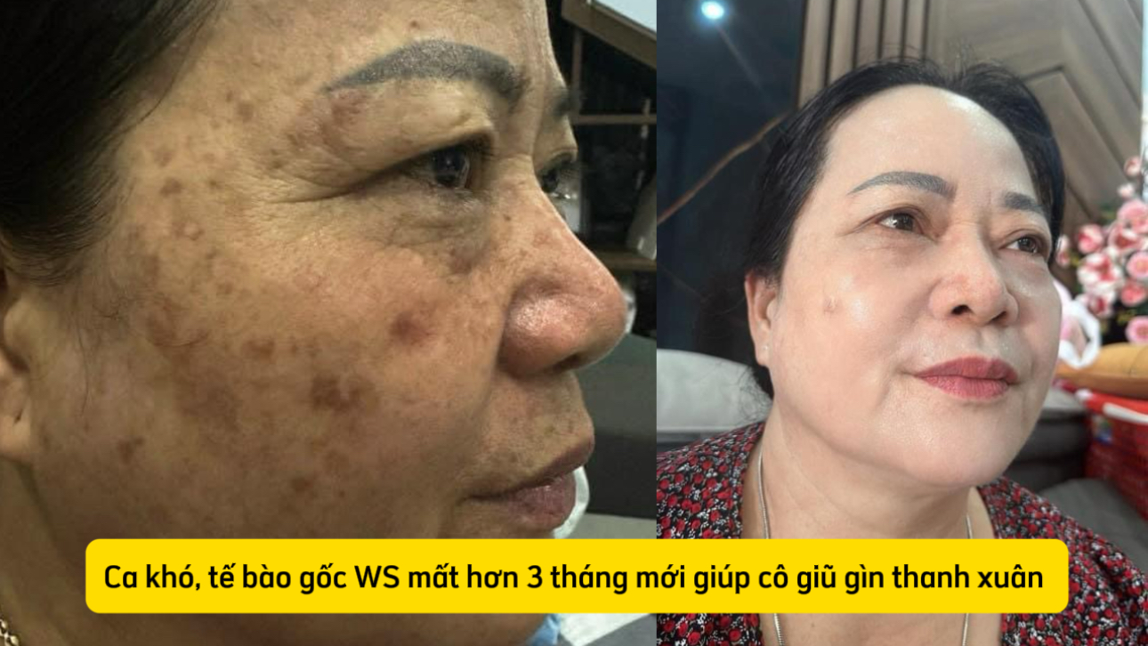 Bộ QUEEN'S FACE (trẻ hoá +Trị nám, trắng da, mềm mượt da, săn chắc da, giảm nhăn, chống lão hoá siêu đỉnh...WS) - Ảnh 2