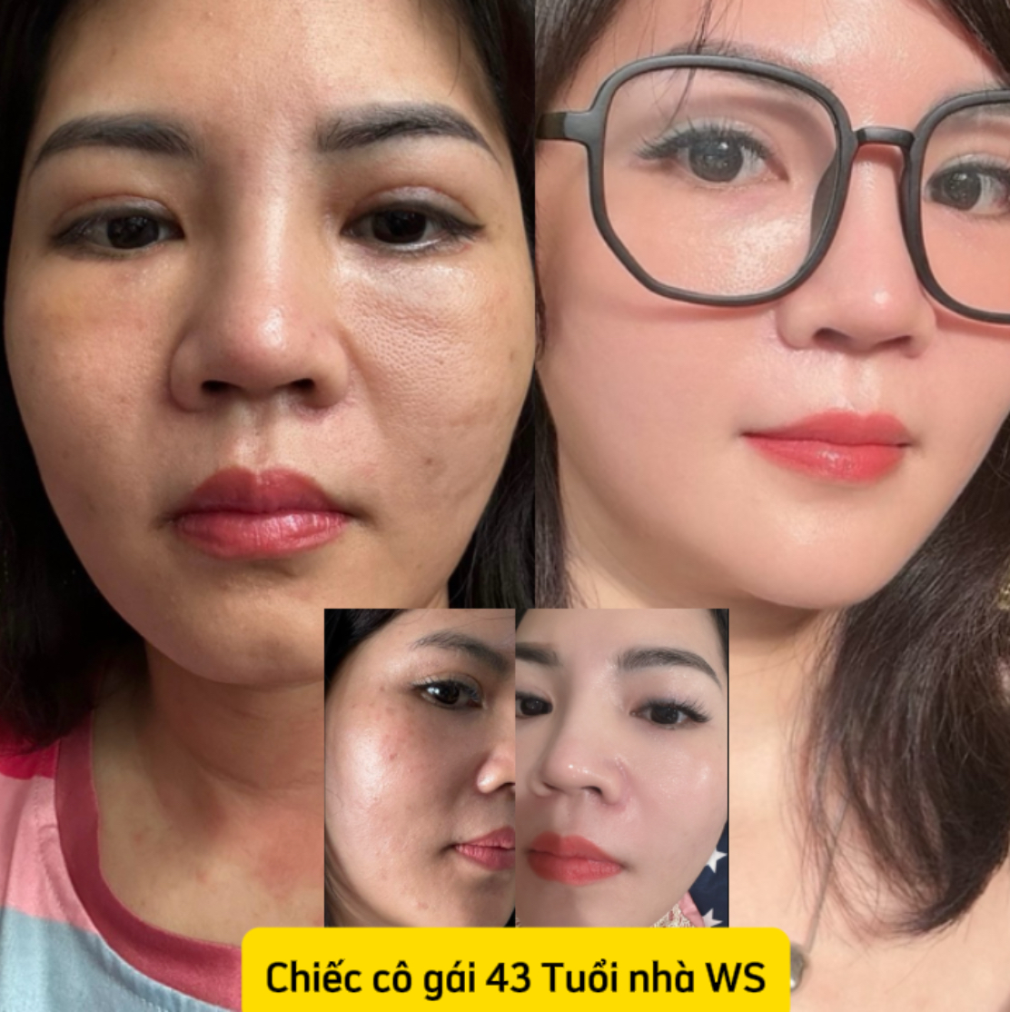 Bộ QUEEN'S FACE (trẻ hoá +Trị nám, trắng da, mềm mượt da, săn chắc da, giảm nhăn, chống lão hoá siêu đỉnh...WS) - Ảnh 3